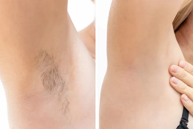 Laser+Before+and+After-640w