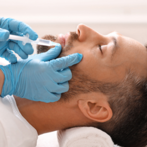 تزریق خط خنده برای آقایان