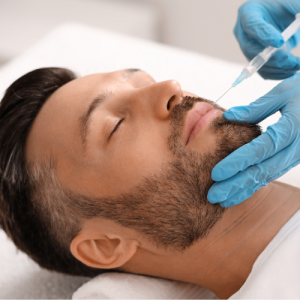 تزریق فیلر لب برای آقایان