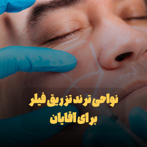 نواحی ترند تزریق فیلر برای آقایان