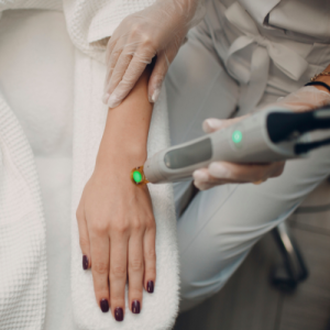 مراقبت های بعد از لیزر کندلا