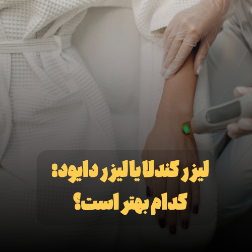 لیزر کندلا یا لیزر دایود
