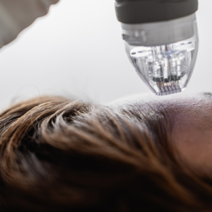 مزونیدلینگ و میکرونیدلینگ