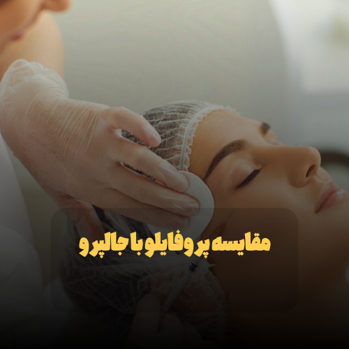 مقایسه پروفایلو با جالپرو