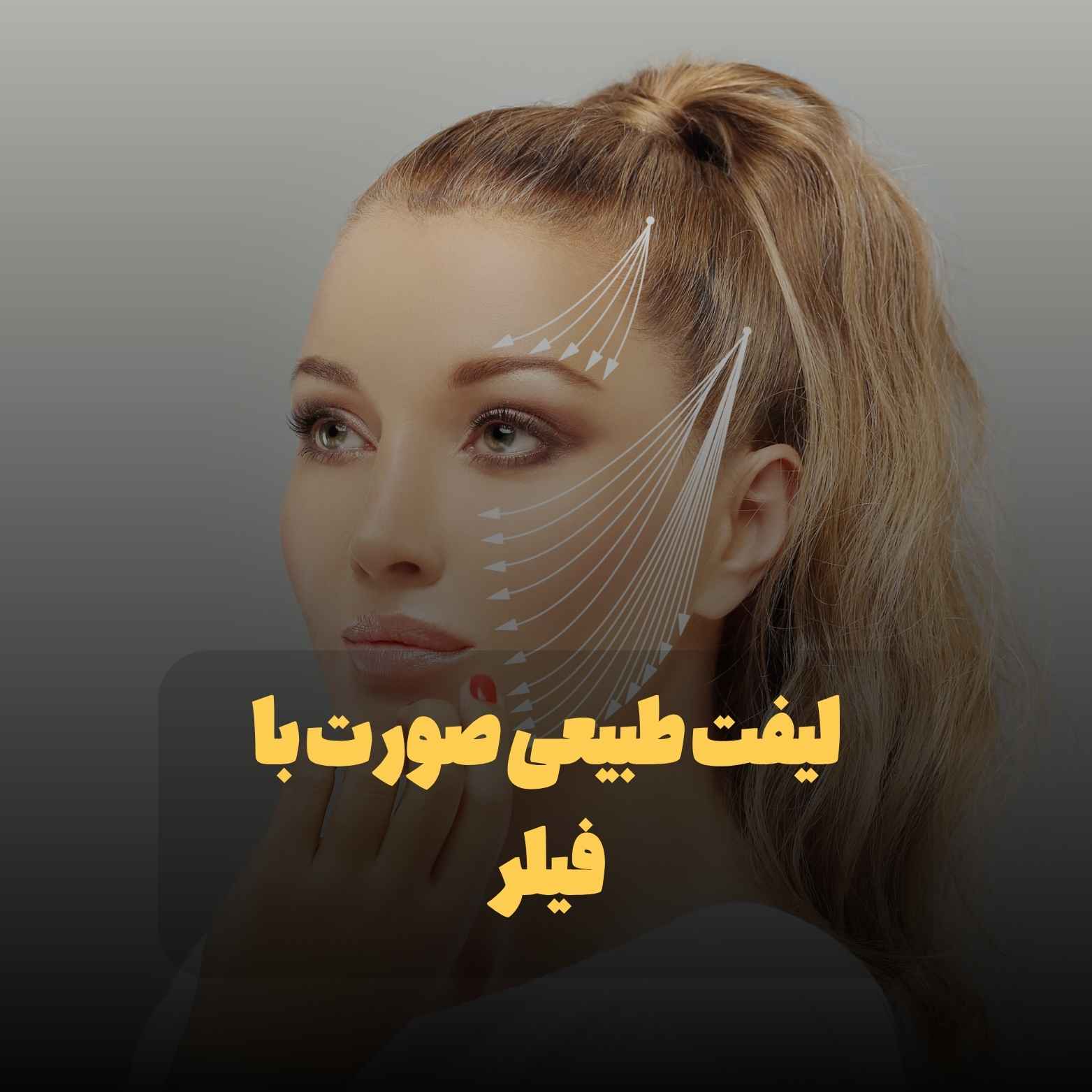 لیفت طبیعی صورت با فیلر