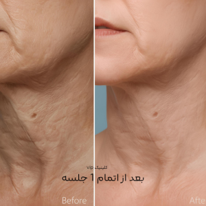 جالپرو گردن در اندیشه