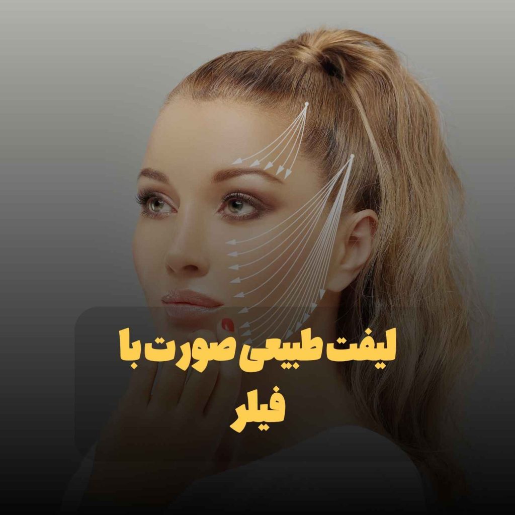 لیفت طبیعی صورت با فیلر