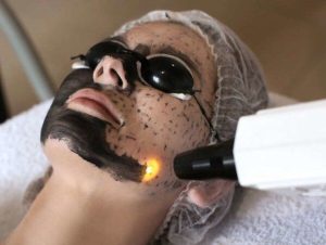 مراقبت های بعد از کربن تراپی