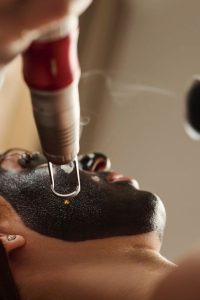 کربن تراپی و مراقبت های بعد از آن