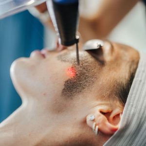 مراقبت های بعد کربن تراپی