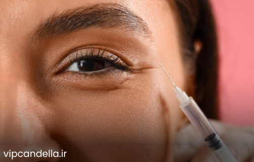 فیلر زیر چشم